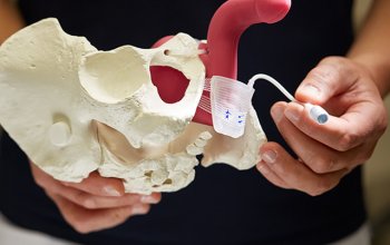 Schliessmuskelprothese nach Prostata OP - Patientenvideo