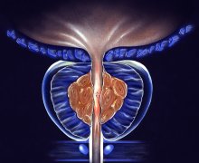 Warum vergrössert sich die Prostata im Alter?