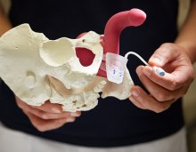 Schliessmuskelprothese nach Prostata OP - Patientenvideo
