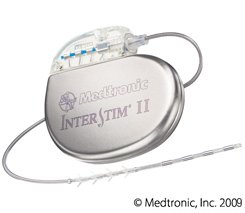 INTERSTIM-Implantat